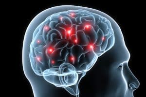Invisible Traumatic Brain Injury