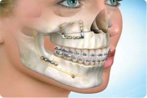 oral-facial-trauma-injury
