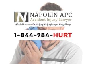 Facial Trauma Injury Lawyer